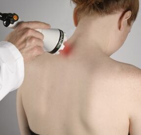 Laser therapy helps relieve inflammation and activate tissue regeneration in the neck