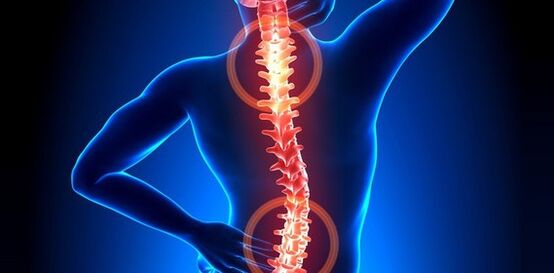 Symptoms of back pain