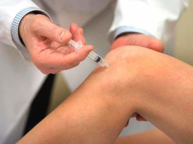 Intra-articular injection is one of the most advanced forms of treatment for osteoarthritis of the knee joint