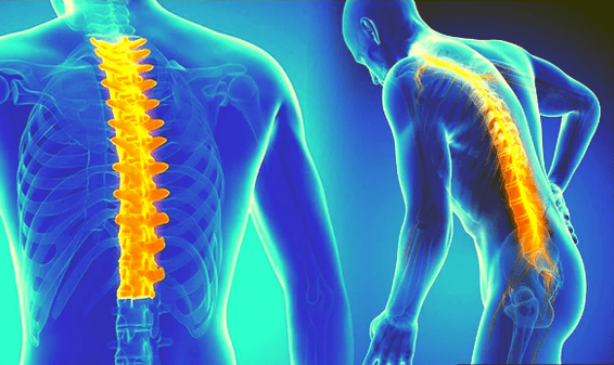 Osteochondrosis of the spine